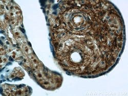 Vertnin Rabbit anti-Human, Polyclonal, Proteintech 150 &mu;L; Unconjugated:Antibodies,