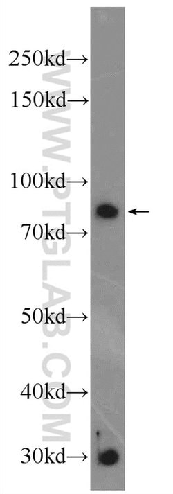Vertnin Rabbit anti-Human, Polyclonal, Proteintech 150 &mu;L; Unconjugated:Antibodies,