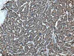 GLDC Rabbit anti-Human, Mouse, Polyclonal, Proteintech 150 μL; Unconjugated:Antibodies,