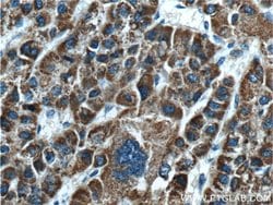 GLDC Rabbit anti-Human, Mouse, Polyclonal, Proteintech 150 μL; Unconjugated:Antibodies,