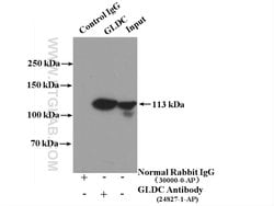 GLDC Rabbit anti-Human, Mouse, Polyclonal, Proteintech 150 μL; Unconjugated:Antibodies,