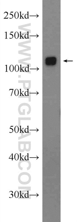 GLDC Rabbit anti-Human, Mouse, Polyclonal, Proteintech 150 μL; Unconjugated:Antibodies,