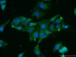 BAIAP3 Rabbit anti-Human, Mouse, Rat, Polyclonal, Proteintech 150 &mu;L;
