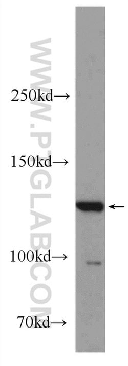 BAIAP3 Rabbit anti-Human, Mouse, Rat, Polyclonal, Proteintech 150 &mu;L;