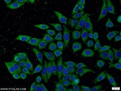 KLHDC5 Rabbit anti-Human, Mouse, Polyclonal, Proteintech 150 &mu;L; Unconjugated:Antibodies,
