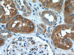 KLHDC5 Rabbit anti-Human, Mouse, Polyclonal, Proteintech 150 &mu;L; Unconjugated:Antibodies,