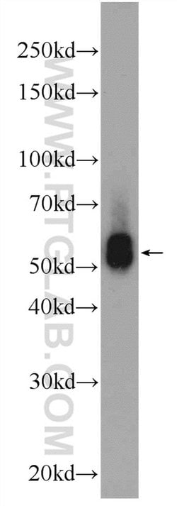 KLHDC5 Rabbit anti-Human, Mouse, Polyclonal, Proteintech 150 &mu;L; Unconjugated:Antibodies,