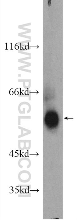 KLHDC5 Rabbit anti-Human, Mouse, Polyclonal, Proteintech 150 &mu;L; Unconjugated:Antibodies,