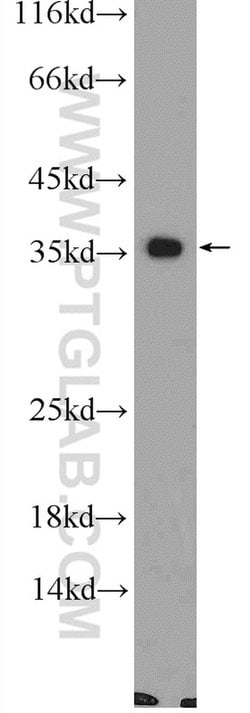 CNTD1 Rabbit anti-Human, Mouse, Polyclonal, Proteintech