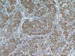 NRBF2 Rabbit anti-Human, Mouse, Polyclonal, Proteintech 150 &mu;L; Unconjugated:Antibodies,