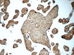 NRBF2 Rabbit anti-Human, Mouse, Polyclonal, Proteintech 150 &mu;L; Unconjugated:Antibodies,