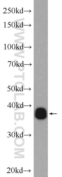 NRBF2 Rabbit anti-Human, Mouse, Polyclonal, Proteintech 150 &mu;L; Unconjugated:Antibodies,
