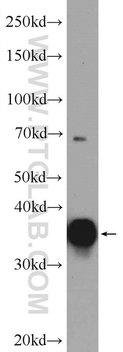 NRBF2 Rabbit anti-Human, Mouse, Polyclonal, Proteintech 150 &mu;L; Unconjugated:Antibodies,