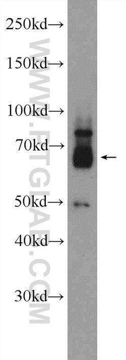 ZNF195 Rabbit anti-Human, Mouse, Polyclonal, Proteintech 150 &mu;L; Unconjugated:Antibodies,