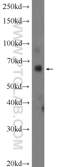 ZNF195 Rabbit anti-Human, Mouse, Polyclonal, Proteintech 150 &mu;L; Unconjugated:Antibodies,