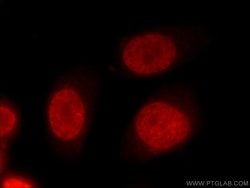 FUBP1 Rabbit anti-Human, Mouse, Polyclonal, Proteintech 150 &mu;L; Unconjugated:Antibodies,