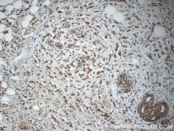 C13orf37 Rabbit anti-Human, Polyclonal, Proteintech:Antibodies:Primary