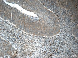 C13orf37 Rabbit anti-Human, Polyclonal, Proteintech:Antibodies:Primary