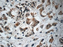 C13orf37 Rabbit anti-Human, Polyclonal, Proteintech:Antibodies:Primary