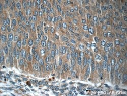 C13orf37 Rabbit anti-Human, Polyclonal, Proteintech:Antibodies:Primary