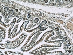 C22orf41 Rabbit anti-Human, Polyclonal, Proteintech 150 μL; Unconjugated:Antibodies,