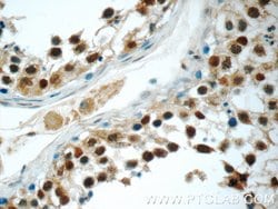C22orf41 Rabbit anti-Human, Polyclonal, Proteintech 150 μL; Unconjugated:Antibodies,