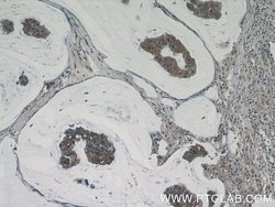 CWF19L2 Rabbit anti-Human, Polyclonal, Proteintech 20 &mu;L | Buy Online | Proteintech | Fisher Scientific