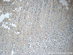 CWF19L2 Rabbit anti-Human, Polyclonal, Proteintech 20 &mu;L | Buy Online | Proteintech | Fisher Scientific