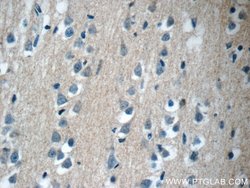 CWF19L2 Rabbit anti-Human, Polyclonal, Proteintech 20 &mu;L | Buy Online | Proteintech | Fisher Scientific