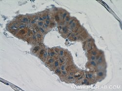 CWF19L2 Rabbit anti-Human, Polyclonal, Proteintech 20 &mu;L | Buy Online | Proteintech | Fisher Scientific