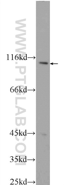 CWF19L2 Rabbit anti-Human, Polyclonal, Proteintech 20 &mu;L | Buy Online | Proteintech | Fisher Scientific