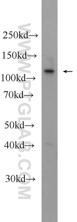 KIAA1217 Rabbit anti-Human, Mouse, Polyclonal, Proteintech 150 &mu;L; Unconjugated:Antibodies,
