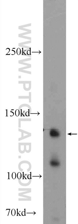 KIAA1217 Rabbit anti-Human, Mouse, Polyclonal, Proteintech 150 &mu;L; Unconjugated:Antibodies,