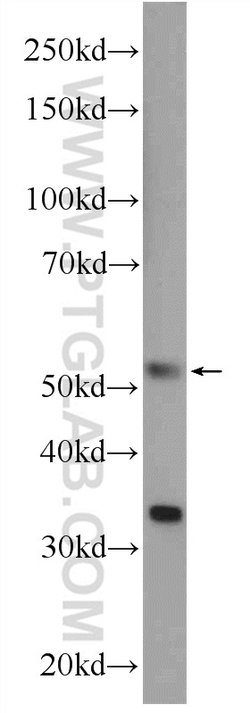PLEKHO1 Rabbit anti-Human, Mouse, Polyclonal, Proteintech:Antibodies:Primary