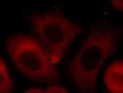 POGK Rabbit anti-Human, Polyclonal, Proteintech 150 &mu;L | Buy Online | Proteintech | Fisher Scientific