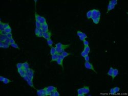 CYP7B1 Rabbit anti-Human, Mouse, Polyclonal, Proteintech 150 &mu;L; Unconjugated:Antibodies,