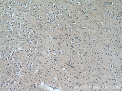 CYP7B1 Rabbit anti-Human, Mouse, Polyclonal, Proteintech 150 &mu;L; Unconjugated:Antibodies,