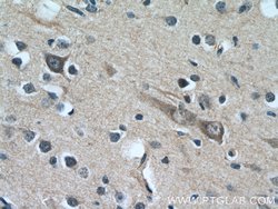 CYP7B1 Rabbit anti-Human, Mouse, Polyclonal, Proteintech 150 &mu;L; Unconjugated:Antibodies,