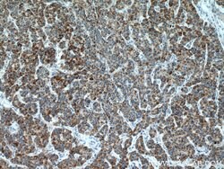 CYP7B1 Rabbit anti-Human, Mouse, Polyclonal, Proteintech 150 &mu;L; Unconjugated:Antibodies,