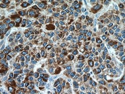 CYP7B1 Rabbit anti-Human, Mouse, Polyclonal, Proteintech 150 &mu;L; Unconjugated:Antibodies,