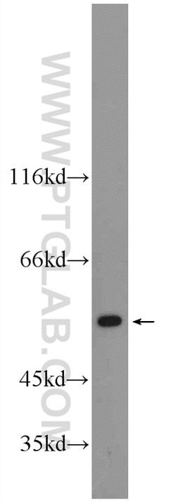 CYP7B1 Rabbit anti-Human, Mouse, Polyclonal, Proteintech 150 &mu;L; Unconjugated:Antibodies,