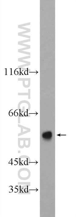 CYP7B1 Rabbit anti-Human, Mouse, Polyclonal, Proteintech 150 &mu;L; Unconjugated:Antibodies,