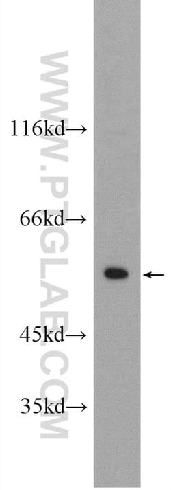CYP7B1 Rabbit anti-Human, Mouse, Polyclonal, Proteintech 150 &mu;L; Unconjugated:Antibodies,