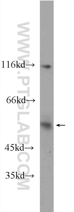 CCT2 Rabbit anti-Human, Mouse, Polyclonal, Proteintech:Antibodies:Primary