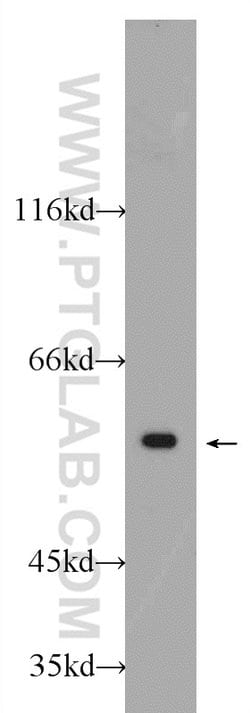 CCT2 Rabbit anti-Human, Mouse, Polyclonal, Proteintech:Antibodies:Primary