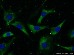 CCT2 Rabbit anti-Human, Mouse, Polyclonal, Proteintech:Antibodies:Primary