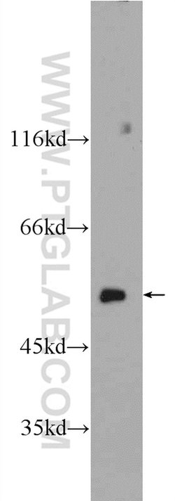 CCT2 Rabbit anti-Human, Mouse, Polyclonal, Proteintech:Antibodies:Primary