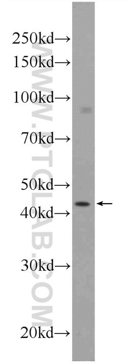 SOX17 Rabbit anti-Human, Mouse, Rat, Polyclonal, Proteintech 150 &mu;L;