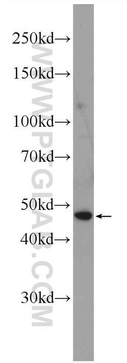 SOX17 Rabbit anti-Human, Mouse, Rat, Polyclonal, Proteintech 150 &mu;L;
