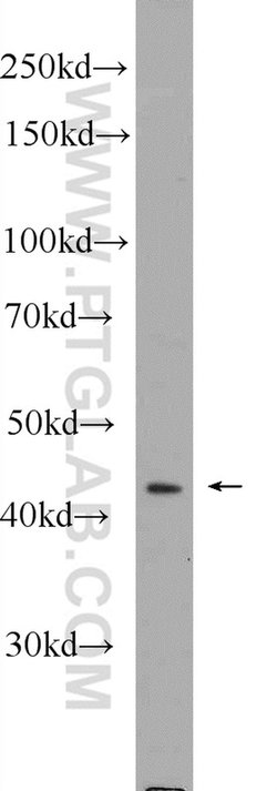SOX17 Rabbit anti-Human, Mouse, Rat, Polyclonal, Proteintech 150 &mu;L;
